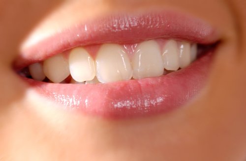 Bọc răng sứ mất bao lâu và phụ thuộc vào các yếu tố nào?